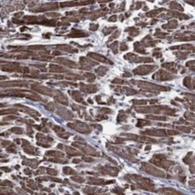 Immunohistochemistry-Paraffin: HTD2 Antibody [NBP3-17969] - Staining of human heart muscle shows strong cytoplasmic positivity in myocytes.