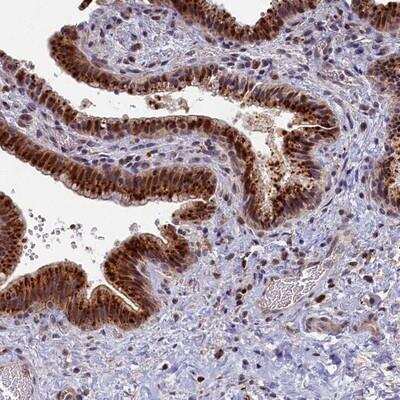 Immunohistochemistry: HUNK Antibody [NBP2-14111] - Staining of human gall bladder shows strong granular cytoplasmic and nuclear positivity in glandular cells.