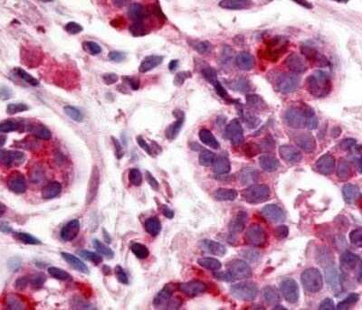 Immunohistochemistry: HUNK Antibody [NLS6920] - Breast
