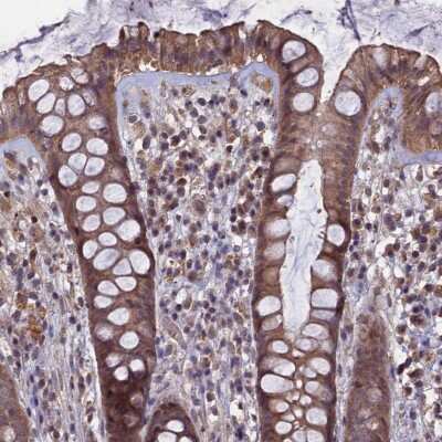 Immunohistochemistry-Paraffin: HUNK Antibody [NBP2-14110] - Staining of human rectum shows moderate cytoplasmic positivity in glandular cells.