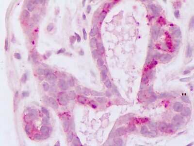 Immunohistochemistry-Paraffin: HUNK Antibody [NLS6920] - Analysis of anti-HUNK / B19 antibody with human breast, epithelium at dilution 4 ug/ml.