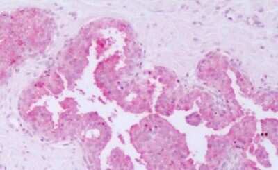 Immunohistochemistry-Paraffin: HUNK Antibody [NLS6920] - Anti-HUNK / B19 antibody IHC of human prostate, epithelium. Immunohistochemistry of formalin-fixed, paraffin-embedded tissue after heat-induced antigen retrieval. Antibody dilution 4 ug/ml.