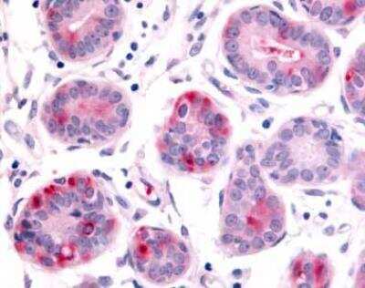 Immunohistochemistry-Paraffin: HUNK Antibody [NLS7095] - Analysis of anti-HUNK / B19 antibody with breast at 8 ug/ml.