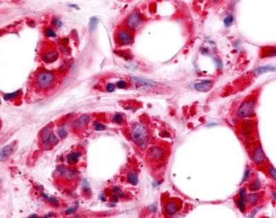 Immunohistochemistry-Paraffin HUNK Antibody - BSA Free