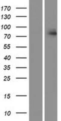 Western Blot: HUNK Overexpression Lysate (Adult Normal) [NBP2-07313] Left-Empty vector transfected control cell lysate (HEK293 cell lysate); Right -Over-expression Lysate for HUNK.