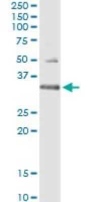 Immunoprecipitation: HUS1 Antibody (2B12) [H00003364-M01] - Analysis of HUS1 transfected lysate using anti-HUS1 monoclonal antibody and Protein A Magnetic Bead, and immunoblotted with HUS1 MaxPab rabbit polyclonal antibody.