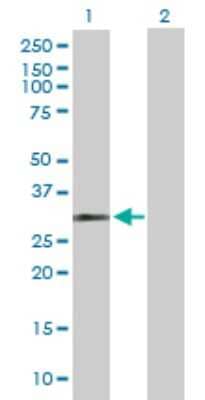 Western Blot: HUS1 Antibody [H00003364-D01P] - Analysis of HUS1 expression in transfected 293T cell line by HUS1 polyclonal antibody.Lane 1: HUS1 transfected lysate(31.70 KDa).Lane 2: Non-transfected lysate.
