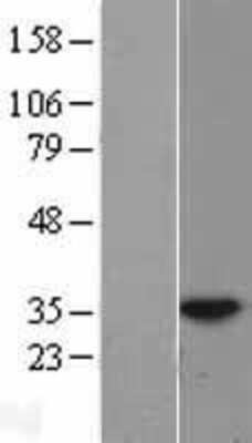 Western Blot: HUS1 Overexpression Lysate (Adult Normal) [NBL1-11788] Left-Empty vector transfected control cell lysate (HEK293 cell lysate); Right -Over-expression Lysate for HUS1.