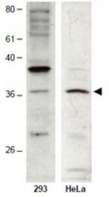 Western Blot: HUS1B Antibody [NBP1-02812] - Analysis of HUS1B antibody in extracts from 293 and Hela cells