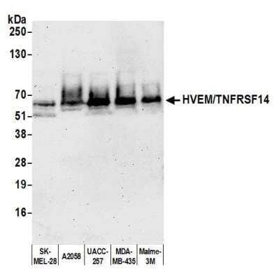 Western Blot: HVEM/TNFRSF14 Antibody (BLR062G) [NBP2-78834] - Detection of human HVEM/TNFRSF14 by WB of SK-MEL-28, A2058, UACC-257, MDA-MB-435, and Malme-3M lysate. Antibody: Rabbit anti-HVEM/TNFRSF14 recombinant monoclonal [BLR062G] (NBP2-78834). Secondary: HRP-conjugated goat anti-rabbit IgG.