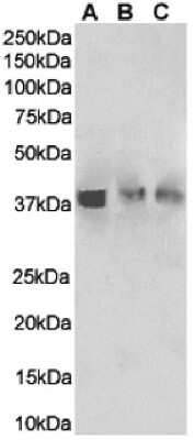 Western Blot: HVEM/TNFRSF14 Antibody (HMHV-1B18) - Chimeric [NBP3-09029] - Mouse spleen(A), mouse thymus (B) and mouse lung(C) tissue lysates (35ug protein in RIPA buffer) were resolved on a SDS PAGE gel and blots were probed with the chimeric rabbit version of HMHV-1B18 (NBP3-09029) at 0.01 ug/ml, before detection using an anti-rabbit secondary antibody. A primary incubation of 1h was used and protein was detected by chemiluminescence.