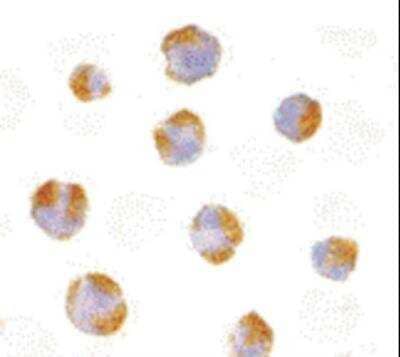 Immunocytochemistry/Immunofluorescence: HVEM/TNFRSF14 Antibody [NB100-80848] - HVEM/TNFRSF14  in Raji 10 ug/ml.