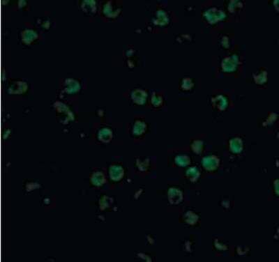 Immunocytochemistry/Immunofluorescence: HVEM/TNFRSF14 Antibody [NB100-80848] - Raji cells with HVEM/TNFRSF14  antibody at 20 ug/ml.