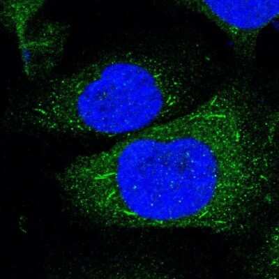 Immunocytochemistry/Immunofluorescence: HVEM/TNFRSF14 Antibody [NBP1-88874] - Staining of human cell line U-2 OS shows localization to cytosol & rods & rings.