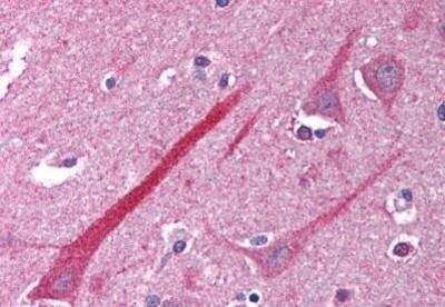Immunohistochemistry-Paraffin: HVEM/TNFRSF14 Antibody [NB100-80848] - Staining of human brain, cortex. Immunohistochemistry of formalin-fixed, paraffin-embedded tissue after heat-induced antigen retrieval. Antibody concentration 5 ug/ml.
