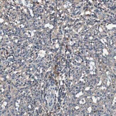 Immunohistochemistry-Paraffin: HVEM/TNFRSF14 Antibody [NBP1-88874] - Staining of human spleen shows weak cytoplasmic positivity in cells in red pulp.