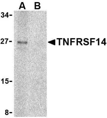 Western Blot: HVEM/TNFRSF14 Antibody [NBP1-76689] - Raji cell lysate with TNFRSF14 antibody at 2 u/mL in (A) the absence and (B) the presence of blocking peptide.