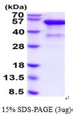 SDS-Page: Recombinant Human HVEM/TNFRSF14 Protein [NBP2-52356] - 15% SDS Page (3 ug)