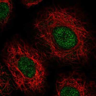 Immunocytochemistry/Immunofluorescence: HVSL1 Antibody [NBP2-56102] - Staining of human cell line A549 shows localization to nucleus.