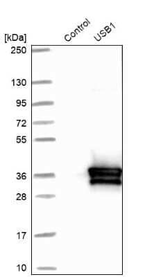 Western Blot: HVSL1 Antibody [NBP1-82268] - Analysis in control (vector only transfected HEK293T lysate) and USB1 over-expression lysate (Co-expressed with a C-terminal myc-DDK tag (3.1 kDa) in mammalian HEK293T cells).