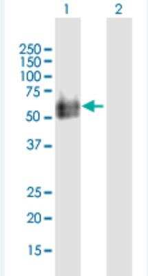 Western Blot: HYAL2 Antibody [H00008692-B02P-50ug] - Analysis of HYAL2 expression in transfected 293T cell line (H00008692-T03) by HYAL2 MaxPab polyclonal antibody.  Lane 1: HYAL2 transfected lysate(52.03 KDa). Lane 2: Non-transfected lysate.