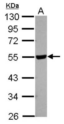 Western Blot: HYAL2 Antibody [NBP2-21609] - Sample (30 ug of whole cell lysate) A: 293T 10% SDS PAGE gel, diluted at 1:1000.