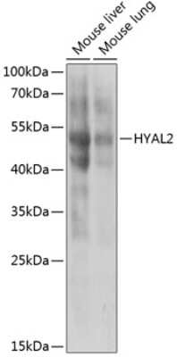 Western Blot: HYAL2 Antibody [NBP3-04995] - Analysis of extracts of various cell lines, using HYAL2 antibody at 1:1000 dilution. Secondary antibody: HRP Goat Anti-Rabbit IgG (H+L) at 1:10000 dilution. Lysates/proteins: 25ug per lane. Blocking buffer: 3% nonfat dry milk in TBST. Detection: ECL Basic Kit