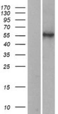 Western Blot: HYAL2 Overexpression Lysate (Adult Normal) [NBL1-11794] Left-Empty vector transfected control cell lysate (HEK293 cell lysate); Right -Over-expression Lysate for HYAL2.