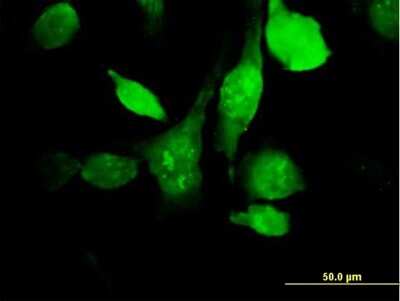 Immunocytochemistry/Immunofluorescence: HYAL3 Antibody [H00008372-B01P] - Analysis of purified antibody to HYAL3 on HeLa cell. (antibody concentration 10 ug/ml)