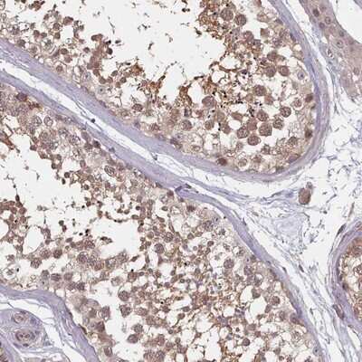 Immunohistochemistry-Paraffin HYAL3 Antibody