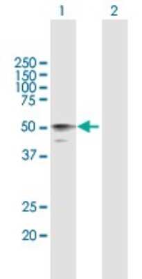 Western Blot: HYAL3 Antibody [H00008372-B01P] - Analysis of HYAL3 expression in transfected 293T cell line by HYAL3 polyclonal antibody.  Lane 1: HYAL3 transfected lysate(45.87 KDa). Lane 2: Non-transfected lysate.