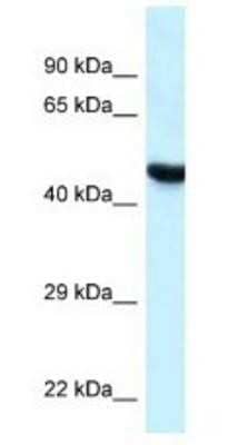 Western Blot: HYAL3 Antibody [NBP1-79911] - MCF7 Cell Lysate 1ug/ml  Gel Concentration 12%