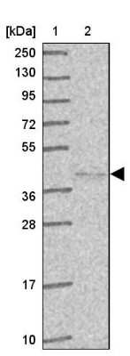 Western Blot HYAL3 Antibody