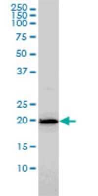 Western Blot: HYI Antibody (2F6) [H00081888-M02] - HYI monoclonal antibody (M02), clone 2F6 Analysis of HYI expression in HL-60.