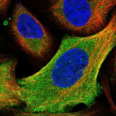 Immunocytochemistry/Immunofluorescence: HYI Antibody [NBP1-81659] - Immunofluorescent staining of human cell line U-2 OS shows localization to plasma membrane & cytosol.