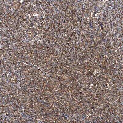 Immunohistochemistry: HYI Antibody [NBP1-81659] - Staining of human ovary shows cytoplasmic positivity in ovarian stroma cells.