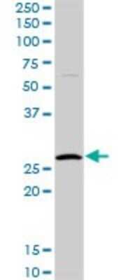 Western Blot: HYI Antibody [H00081888-D01P] - Analysis of HYI expression in human liver.