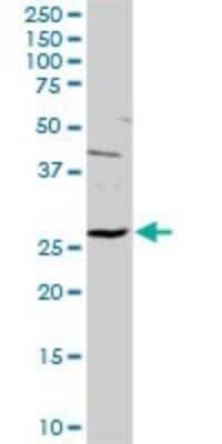Western Blot: HYI Antibody [H00081888-D01P] - Analysis of HYI expression in mouse liver.