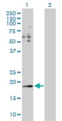 Western Blot: HYI Antibody [H00081888-D01P] - Analysis of HYI expression in transfected 293T cell line by HYI polyclonal antibody.Lane 1: HYI transfected lysate(19.10 KDa).Lane 2: Non-transfected lysate.