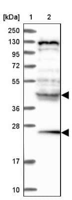 Western Blot: HYI Antibody [NBP1-81659] - Lane 1: Marker  [kDa] 250, 130, 95, 72, 55, 36, 28, 17, 10.  Lane 2: Human cell line RT-4
