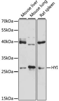 Western Blot: HYI Antibody [NBP3-05159] - Analysis of extracts of various cell lines, using HYI antibody at 1:3000 dilution. Secondary antibody: HRP Goat Anti-Rabbit IgG (H+L) at 1:10000 dilution. Lysates/proteins: 25ug per lane. Blocking buffer: 3% nonfat dry milk in TBST. Detection: ECL Enhanced Kit.