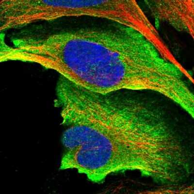 Immunocytochemistry/ Immunofluorescence HYLS1 Antibody - BSA Free