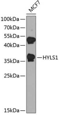 Western Blot: HYLS1 Antibody [NBP3-05148] - Analysis of extracts of MCF-7 cells, using HYLS1 antibody at 1:1000 dilution. Secondary antibody: HRP Goat Anti-Rabbit IgG (H+L) at 1:10000 dilution. Lysates/proteins: 25ug per lane. Blocking buffer: 3% nonfat dry milk in TBST. Detection: ECL Basic Kit .