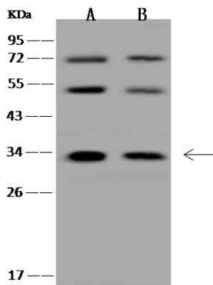 Western Blot HYLS1 Antibody - BSA Free