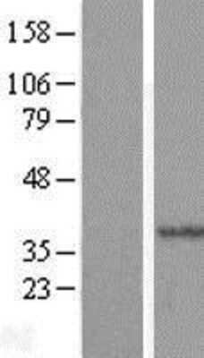Western Blot: HYLS1 Overexpression Lysate (Adult Normal) [NBL1-11797] Left-Empty vector transfected control cell lysate (HEK293 cell lysate); Right -Over-expression Lysate for HYLS1.