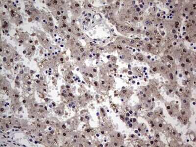 Immunohistochemistry: HYPB Antibody (OTI1E1) - Azide and BSA Free [NBP2-71850] - Analysis of Human embryonic liver tissue.(Heat-induced epitope retrieval by 1 mM EDTA in 10mM Tris, pH8.5, 120C for 3min)