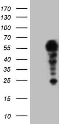 Western Blot: HYPB Antibody (OTI1E1) - Azide and BSA Free [NBP2-71850] - Human recombinant protein fragment corresponding to amino acids 1787-2144 of human SETD2 (NP_085487) produced in E.coli.