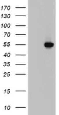 Western Blot: HYPE Antibody (2A11) [NBP2-45664] - Analysis of HEK293T cells were transfected with the pCMV6-ENTRY control (Left lane) or pCMV6-ENTRY HYPE.