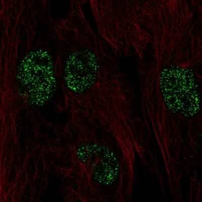 Immunocytochemistry/Immunofluorescence: HYPE Antibody [NBP2-58855] - Staining of human cell line BJ shows localization to nucleus.