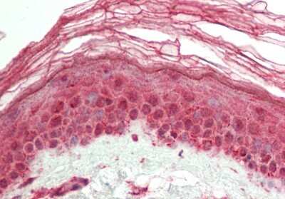 Immunohistochemistry-Paraffin: Hairless Antibody [NBP2-87553] - Rabbit Anti-HR antibody. Formalin Fixed Paraffin Embedded Tissue: Human Skin. Primary antibody Concentration: 1:100. Secondary Antibody: Donkey anti-Rabbit-Cy3. Secondary Antibody Concentration: 1:200. Magnification: 20x.